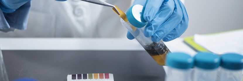 體外哺乳動物細胞基因突變試驗