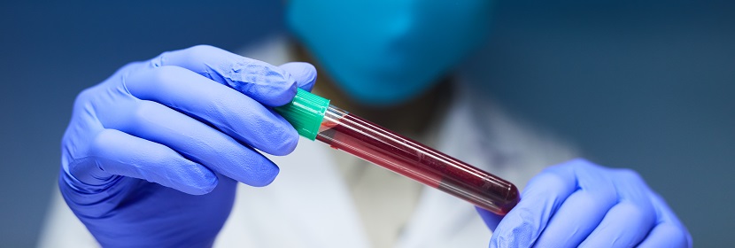 2,4-二叔丁基苯酚檢測